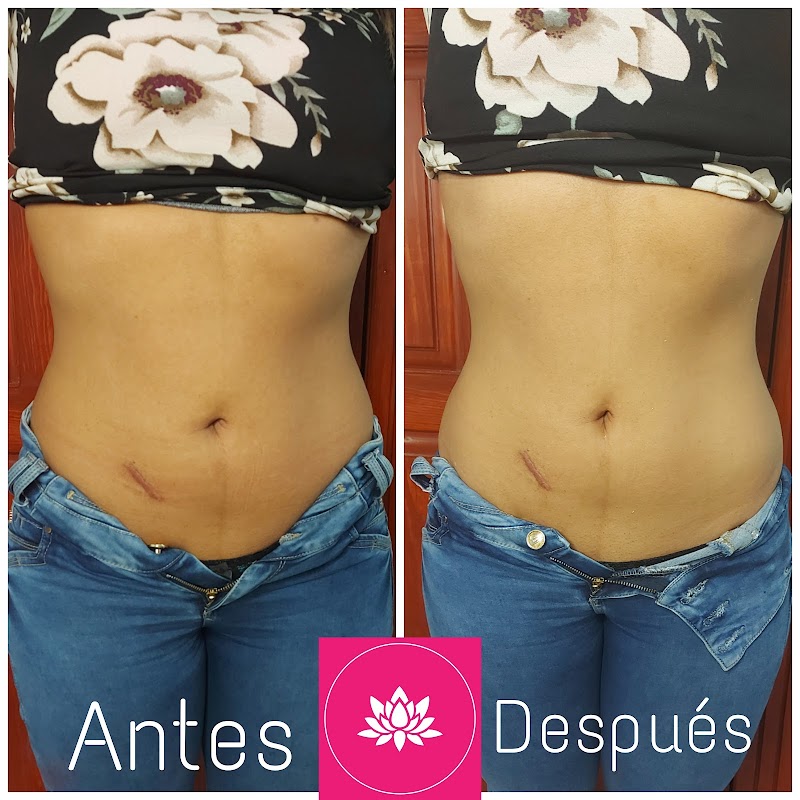 Shalom SPA Apodaca - Day Spa in Apodaca