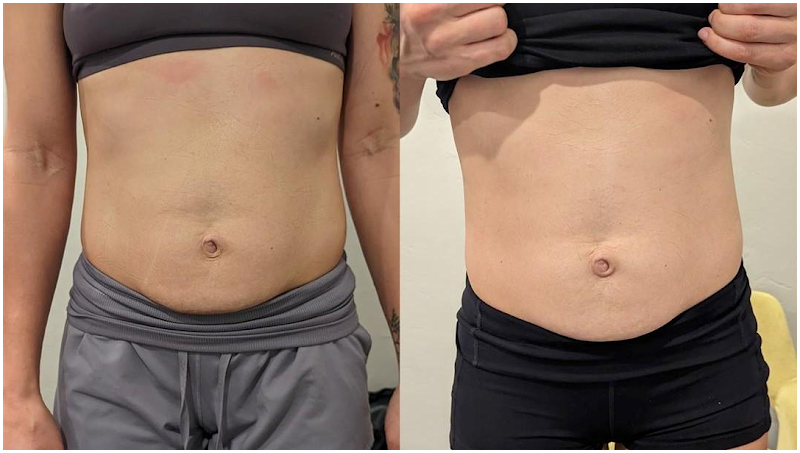 Silhouette Defined LLC Gainesville - Day Spa in Gainesville