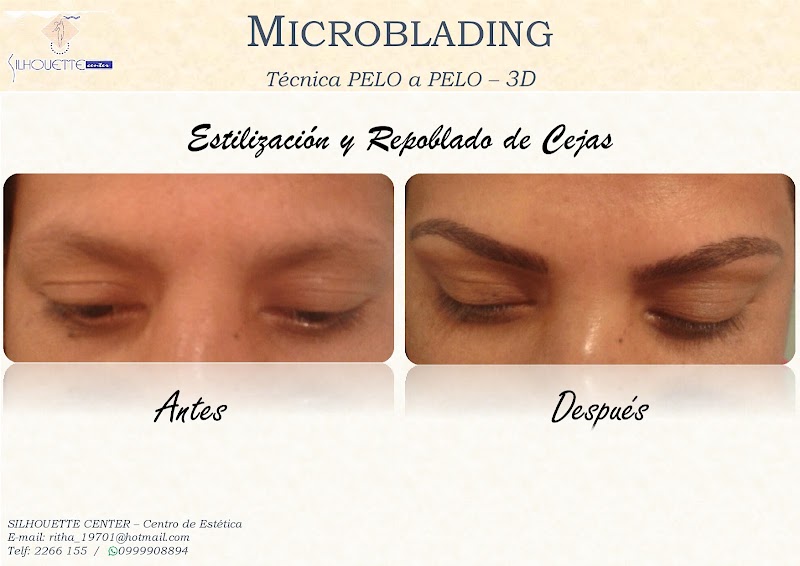 Siluete Brasil Quito - Day Spa in Quito