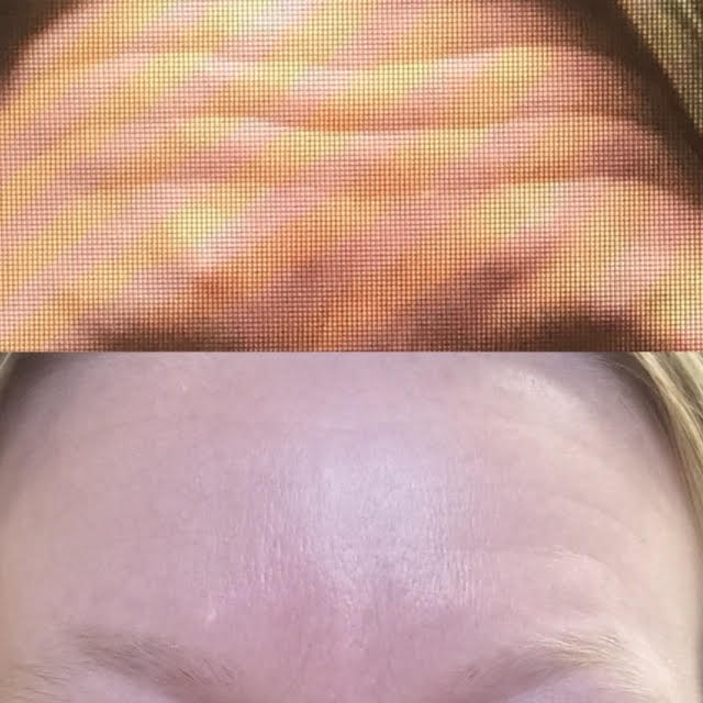 Skin Deep Injectables, LLC Garland - Day Spa in Garland