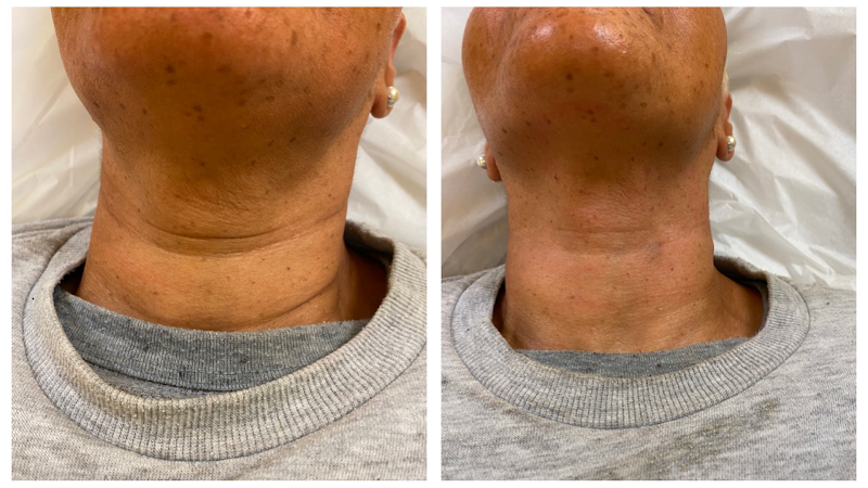 Skin Esteem Medical, Aesthetics, & IV Infusion Spa, Queens New York Saint Albans - Medical Spa in Saint Albans