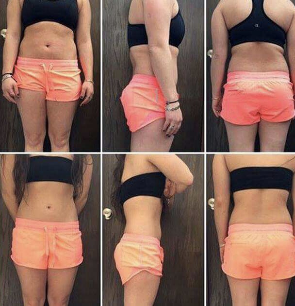 Skin Up, Aesthetic Medicine Cuajimalpa de Morelos - Day Spa in Cuajimalpa de Morelos