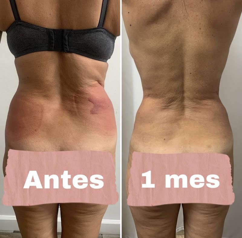 Slim Body Center West Palm Beach - Day Spa in West Palm Beach