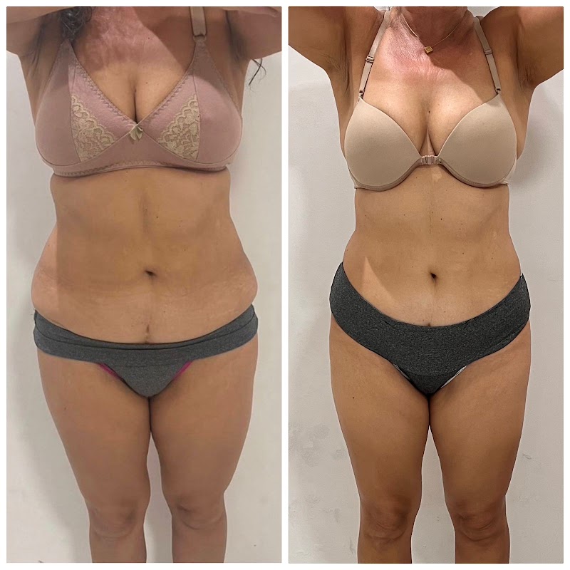 SLS Clinica de Estética Belo Horizonte - Medical Spa in Belo Horizonte