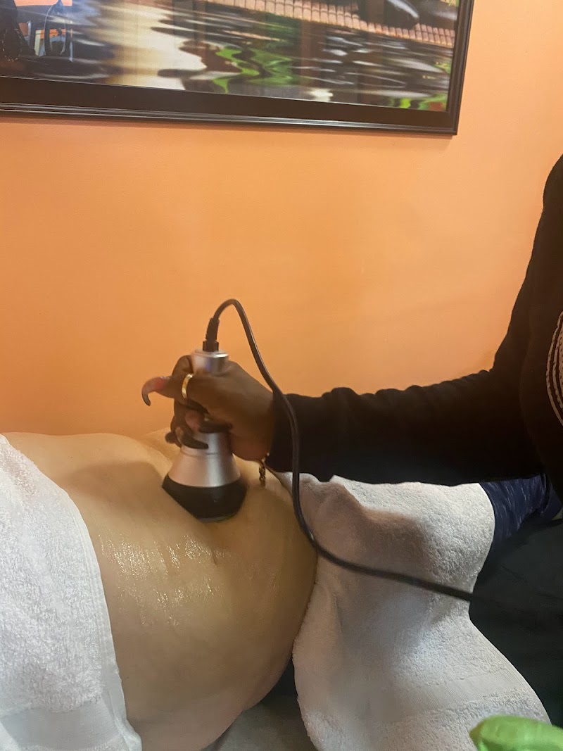 Smart Curves Laser Lipo Center Long Beach - Day Spa in Long Beach