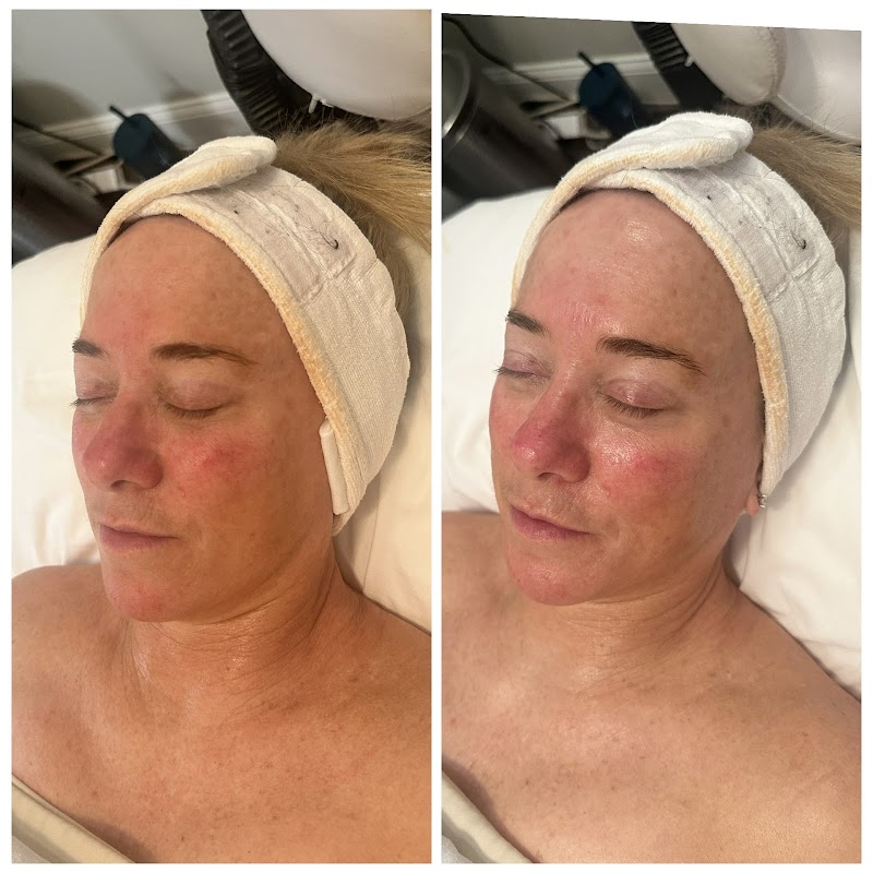 Spa Larimar New Bedford - Day Spa in New Bedford