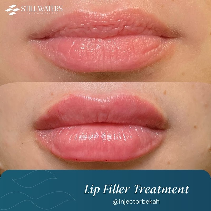 Still Waters Natural Wellness Spa Greenwood - Wellness Retreat in Greenwood