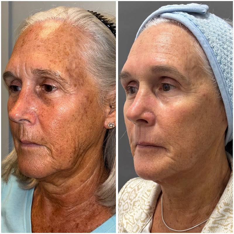 Sublime Spa Treatments Bonita Springs - Day Spa in Bonita Springs