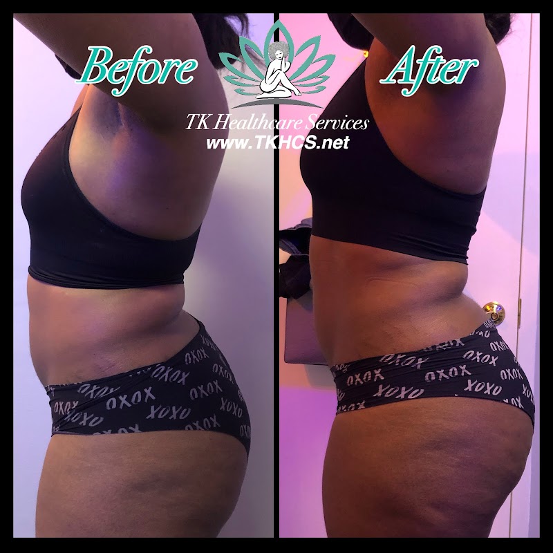 TK Healthcare Services Glen Burnie - Day Spa in Glen Burnie