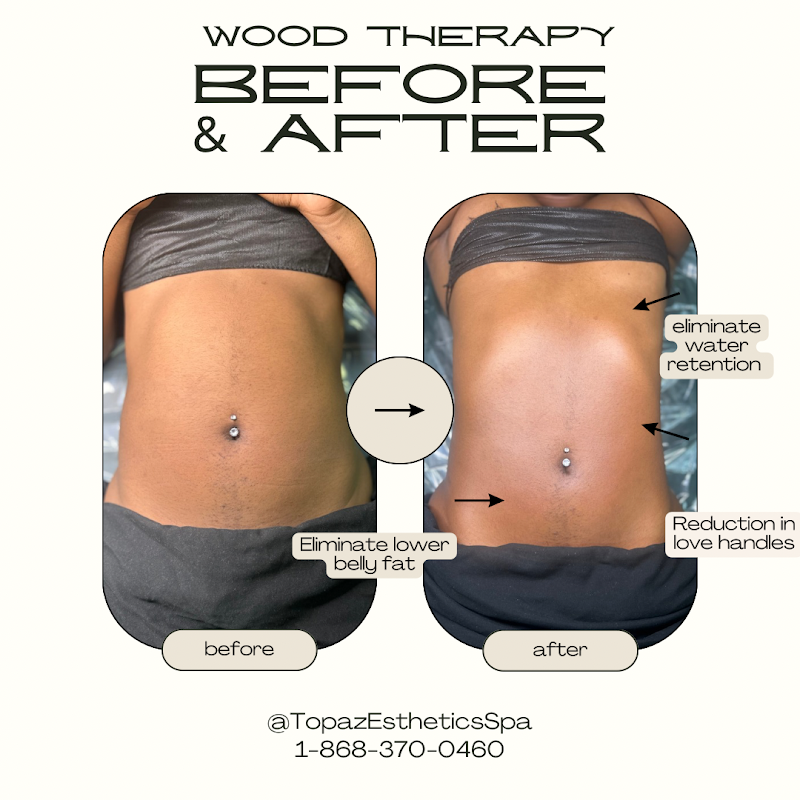 Topaz Esthetics Spa Couva-Tabaquite-Taiparo - Day Spa in Couva-Tabaquite-Taiparo