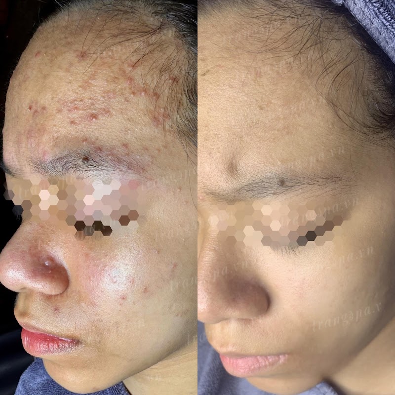 Trang Tây Beauty Spa Quận Long Biên - Day Spa in Quận Long Biên