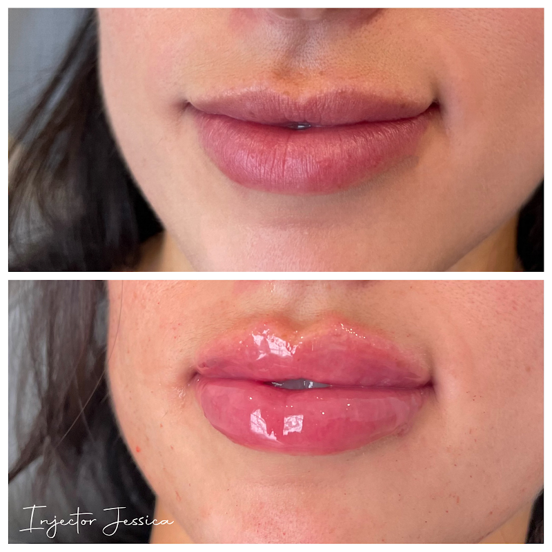 Trouvaille Med Spa Bonita Springs - Day Spa in Bonita Springs