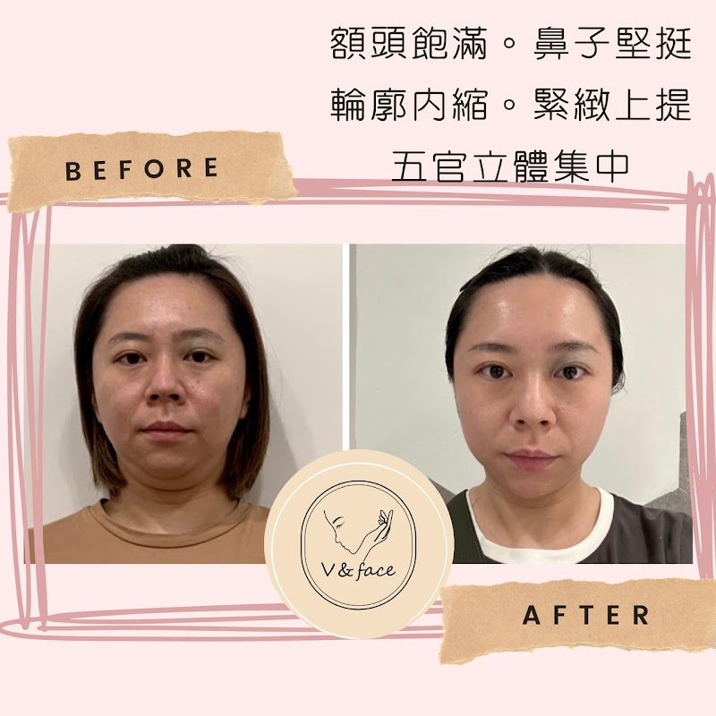 V&Face Small Face Beauty Taipei City - Day Spa in Taipei City