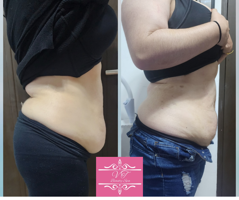 VTbeautyspa Pesquería - Day Spa in Pesquería