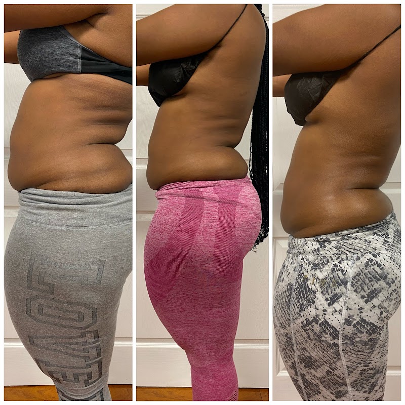 Westchester Body Sculpting Thornwood - Day Spa in Thornwood