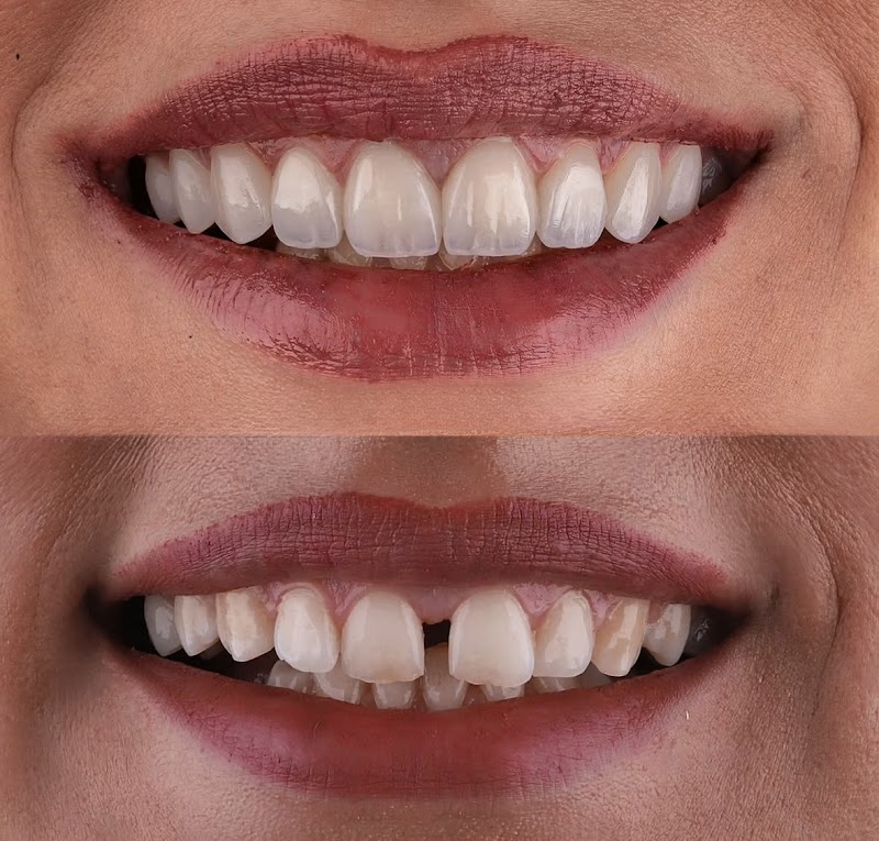 White Smile Clinic Kafr Qasim - Day Spa in Kafr Qasim