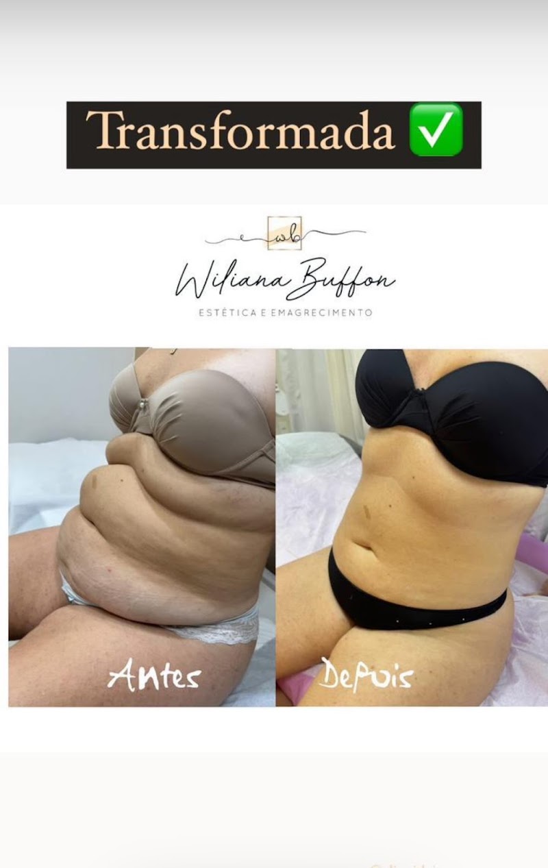 Wiliana Buffon Estética e Emagrecimento Linhares - Day Spa in Linhares