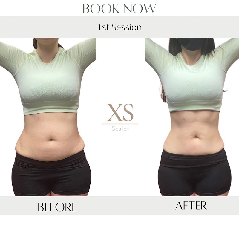 XS Sculpt Garden Grove - Day Spa in Garden Grove