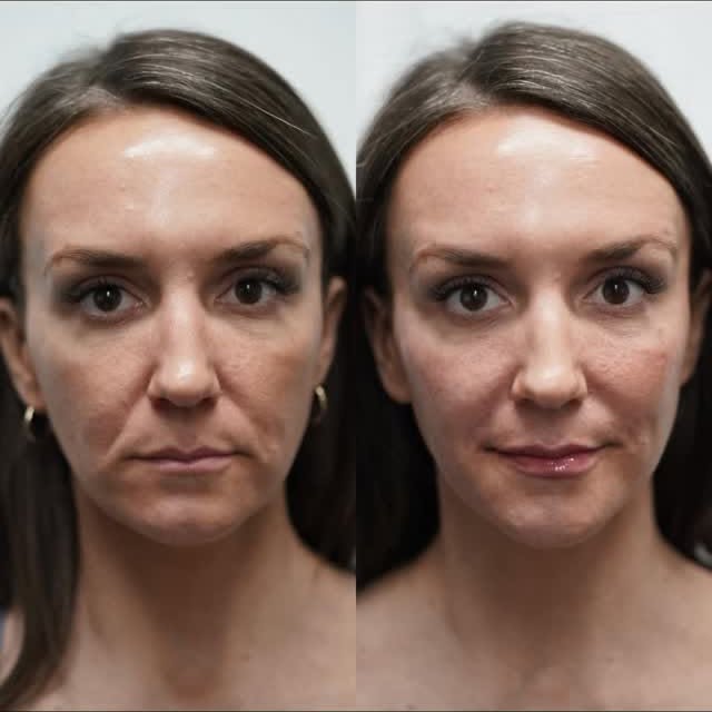 Young Medical Spa King Of Prussia - Medical Spa in King Of Prussia