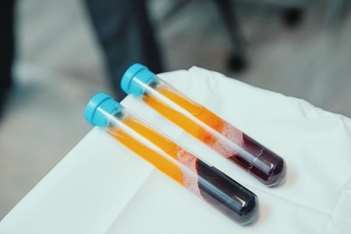 Your SkinCare Nurse Winnipeg - Day Spa in Winnipeg